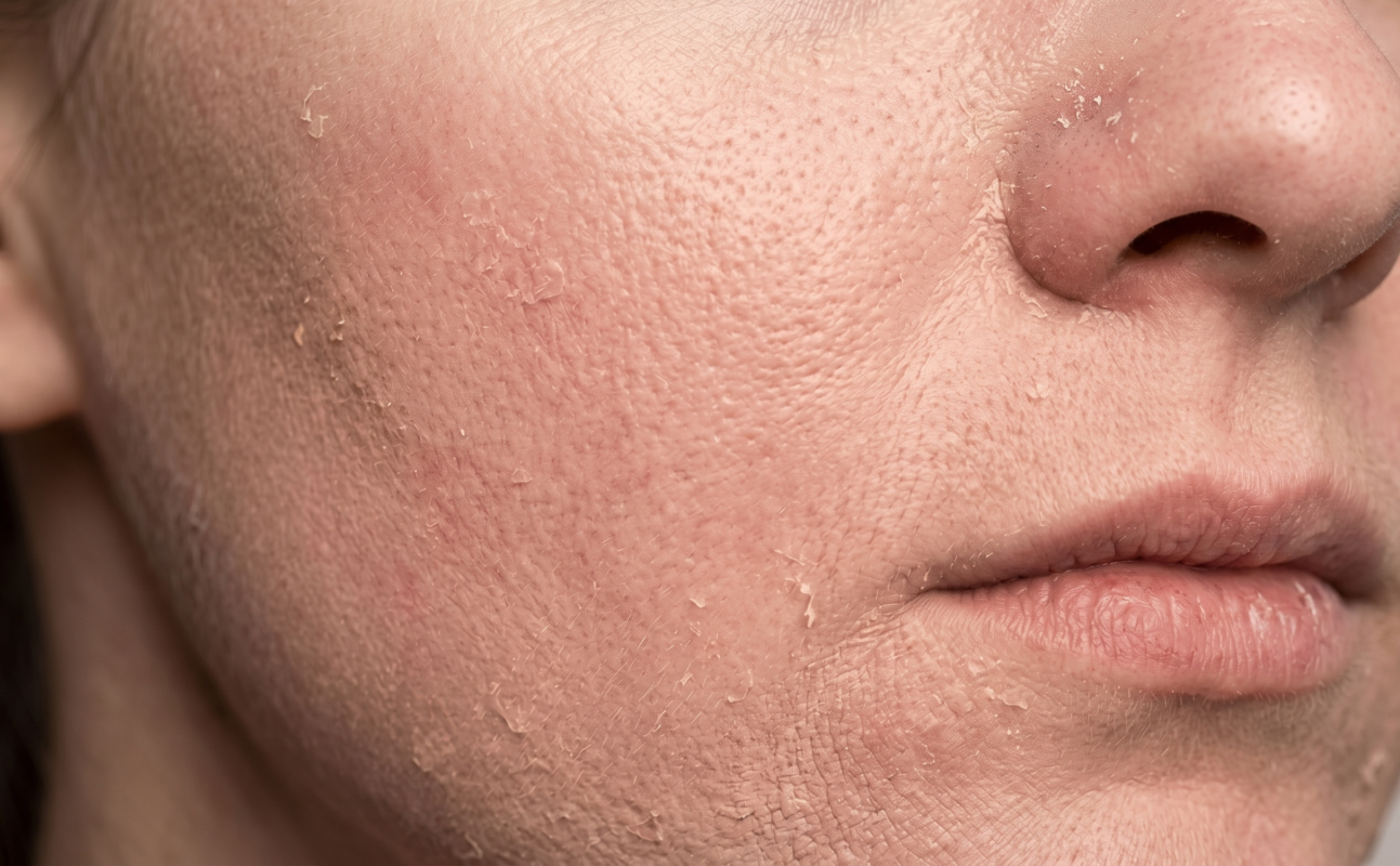 hidratacion facial profunda